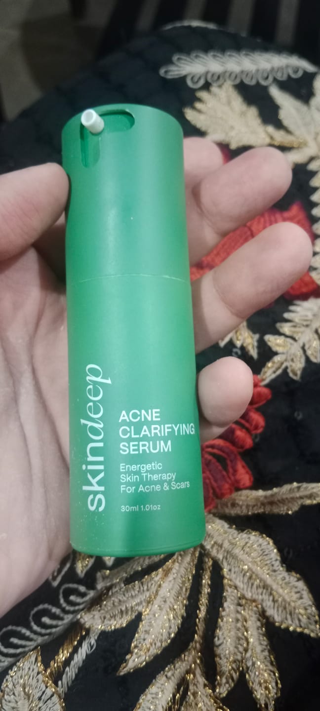 Customer photo review of ACNE CLARIFYING SERUM - Energetic Skin Therapy for Acne & Scars