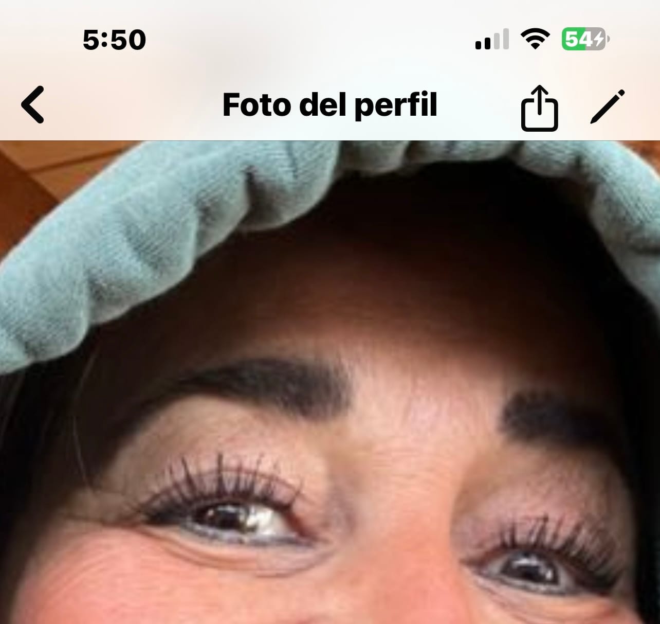 Customer photo review of LV CHAMPS EYELASH SERUM