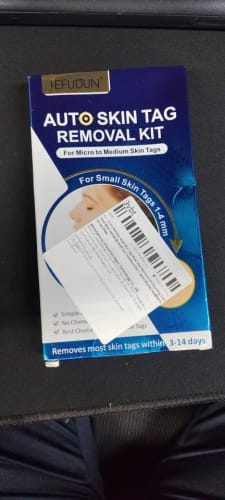 Customer photo review of ערכה להסרת תגי עור SkinTagGone™