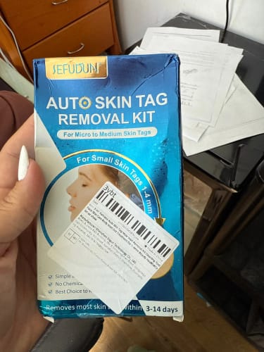 Customer photo review of ערכה להסרת תגי עור SkinTagGone™
