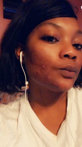 Customer photo review of Turmeric Glow Soap