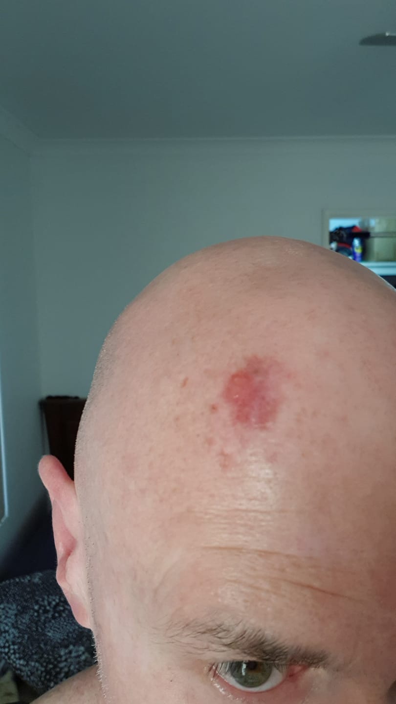 Customer photo review of MAGNESIUM SUPER STICK