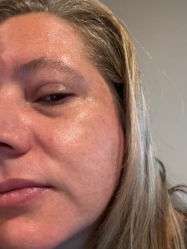 Customer photo review of Face Oil (Moisture Absolute)