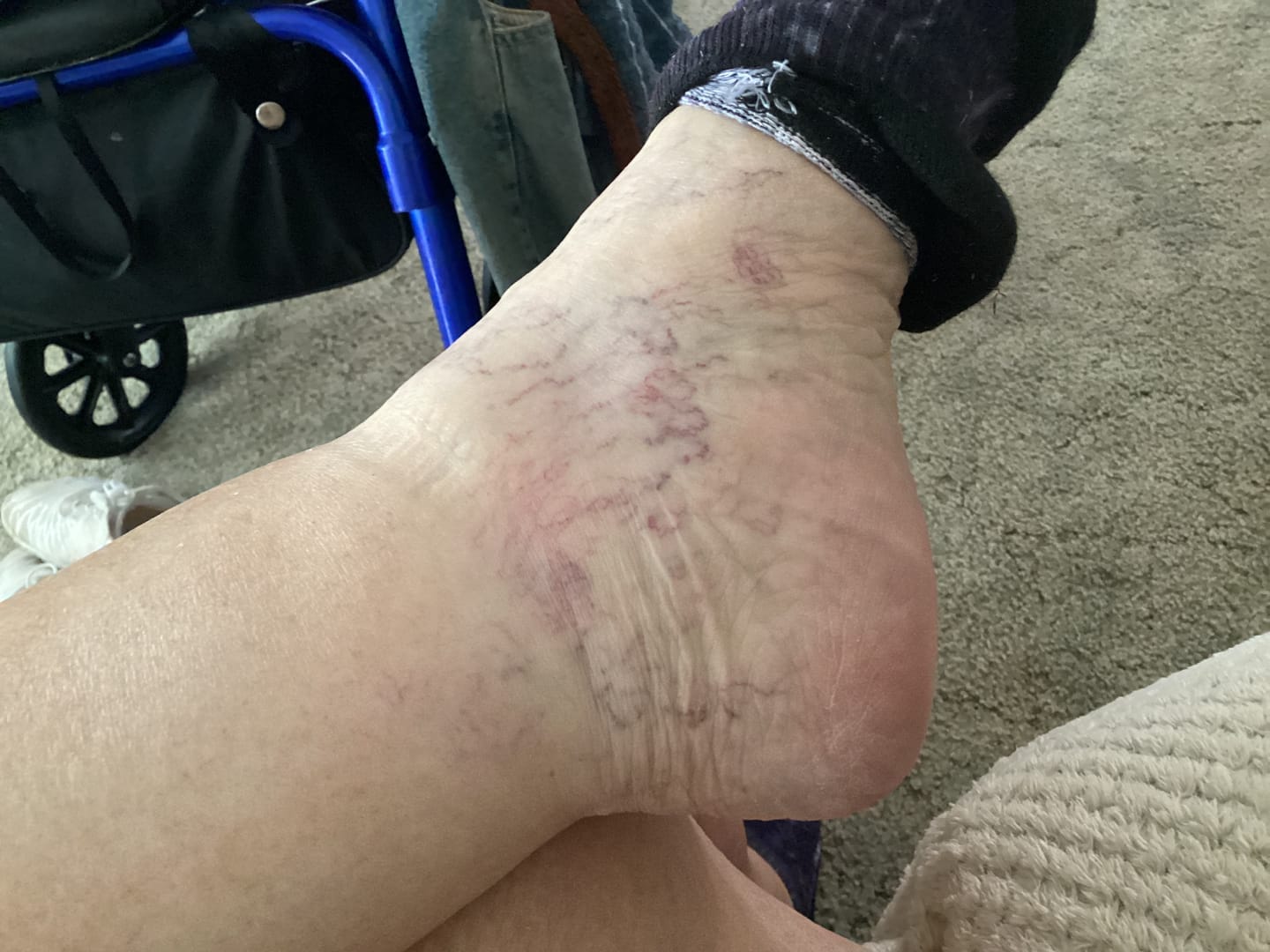 Customer photo review of Night Nature Ankle Compression Socks 5-Pack Bundle