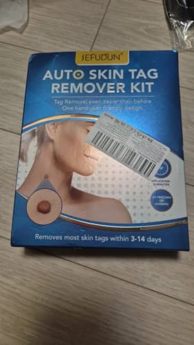 Customer photo review of ערכה להסרת תגי עור SkinTagGone™