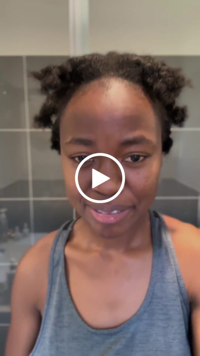Customer video review of Hair Recovery Bundle