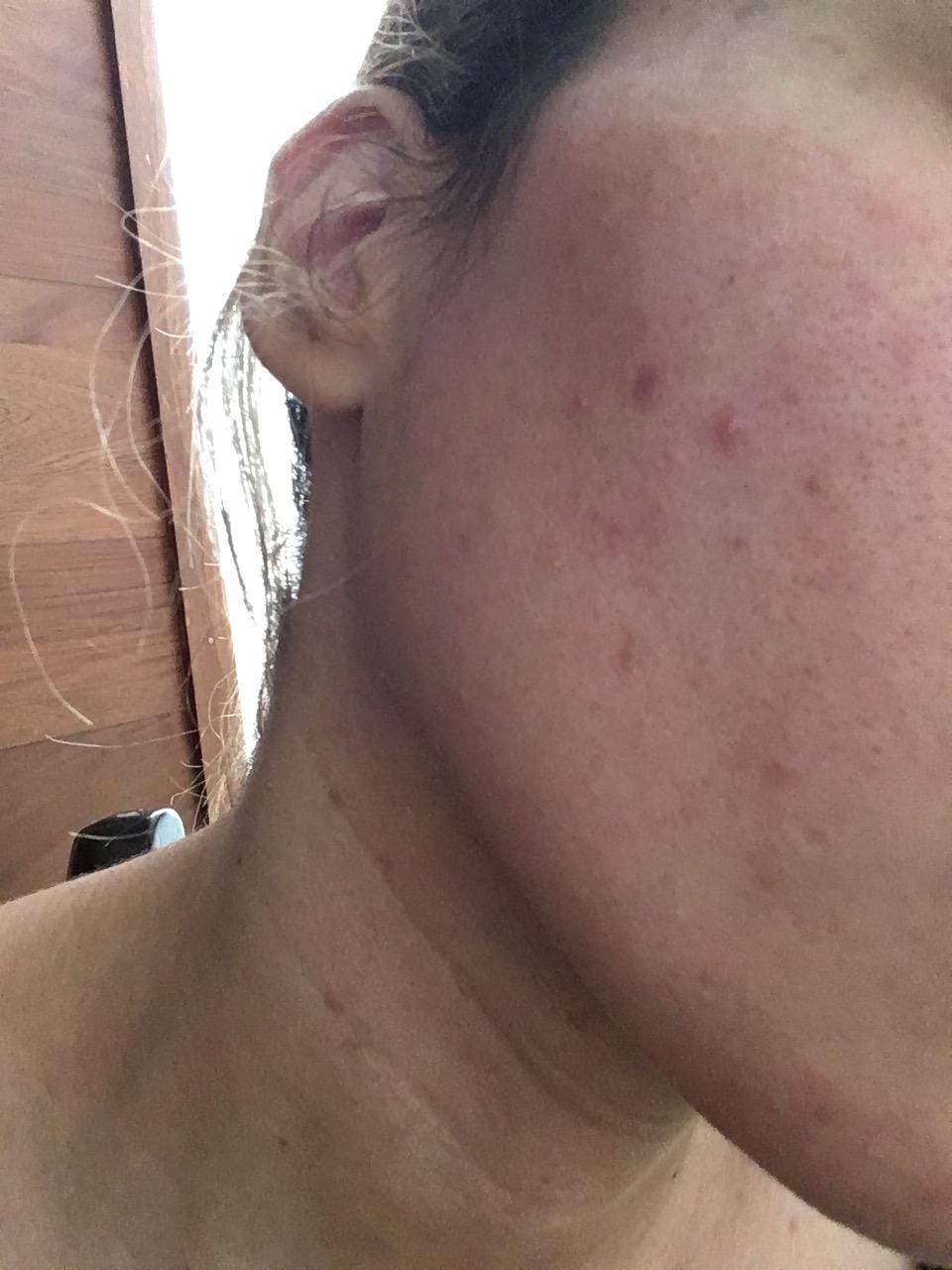 Customer photo review of Tónico Iluminador Aclarante