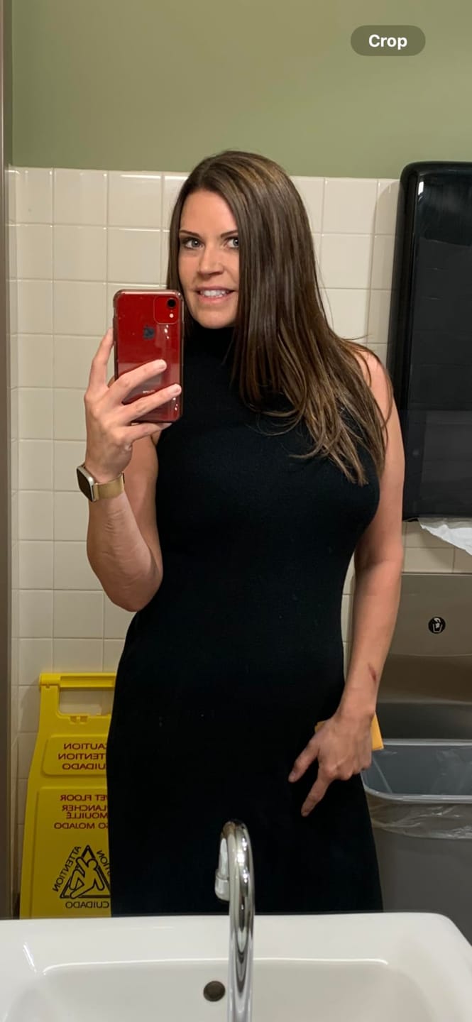 Customer photo review of 3x5 Inches Human Hair Toppers Mono Base Darkest Brown #2