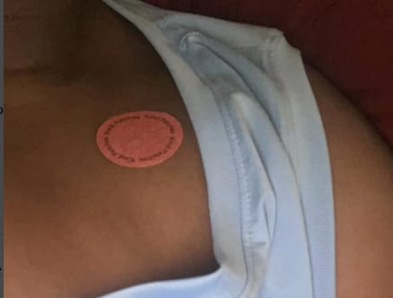 Customer photo review of Glumi Patch GLP-1