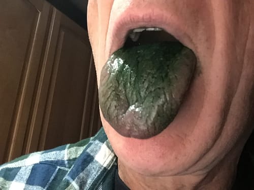 Customer photo review of BetterLungs® Mullein + Chlorophyll