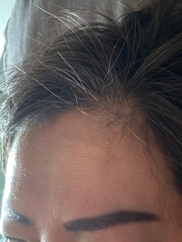 Customer photo review of Rosemary Hair Growth Shampoo - 500ml