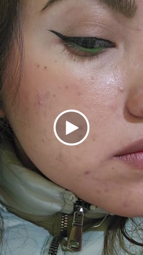 Customer video review of SkinReset - Crema reparadora