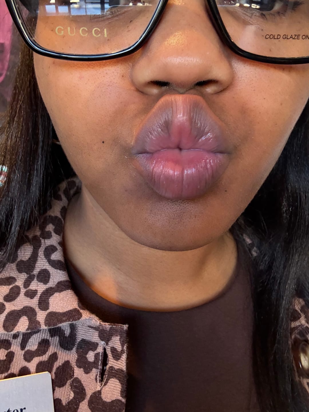 Customer photo review of Lips Lightening Cream For Men and Women (Results in 5 Days or Less)
