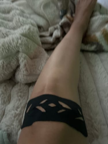 Customer photo review of Easy Kinesiology Tape (30-Day Supply)