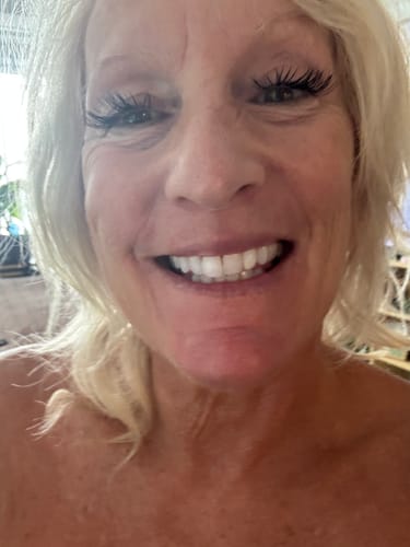 Customer photo review of F-Balm - Premium Anti-aging Tallow Balm - 2 oz.