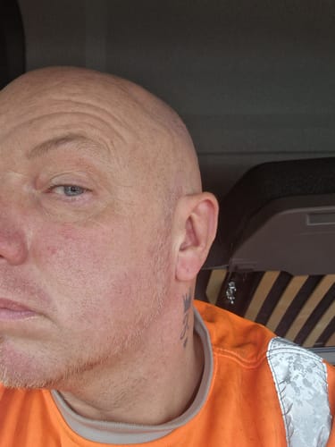 Customer photo review of Seb Natural Calming Serum