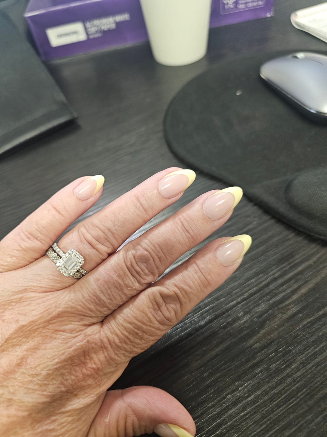Customer photo review of Sunny Tips | Salon Quality Press-on Nails Kit - Short Almond Yellow French Tip