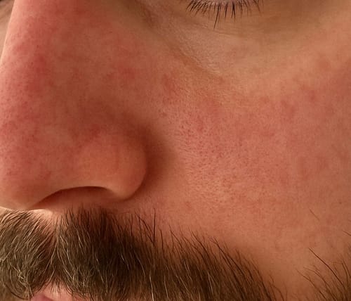 Customer photo review of Seb Natural Calming Serum
