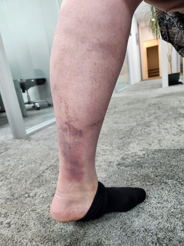 Customer photo review of Magnesium