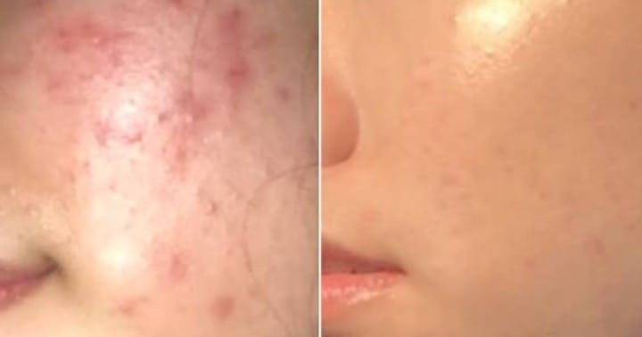 Customer photo review of Dermive Hydrating Serum