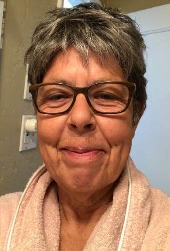 Customer photo review of High-Quality Short Hair Topper For Women With Thinning Hair