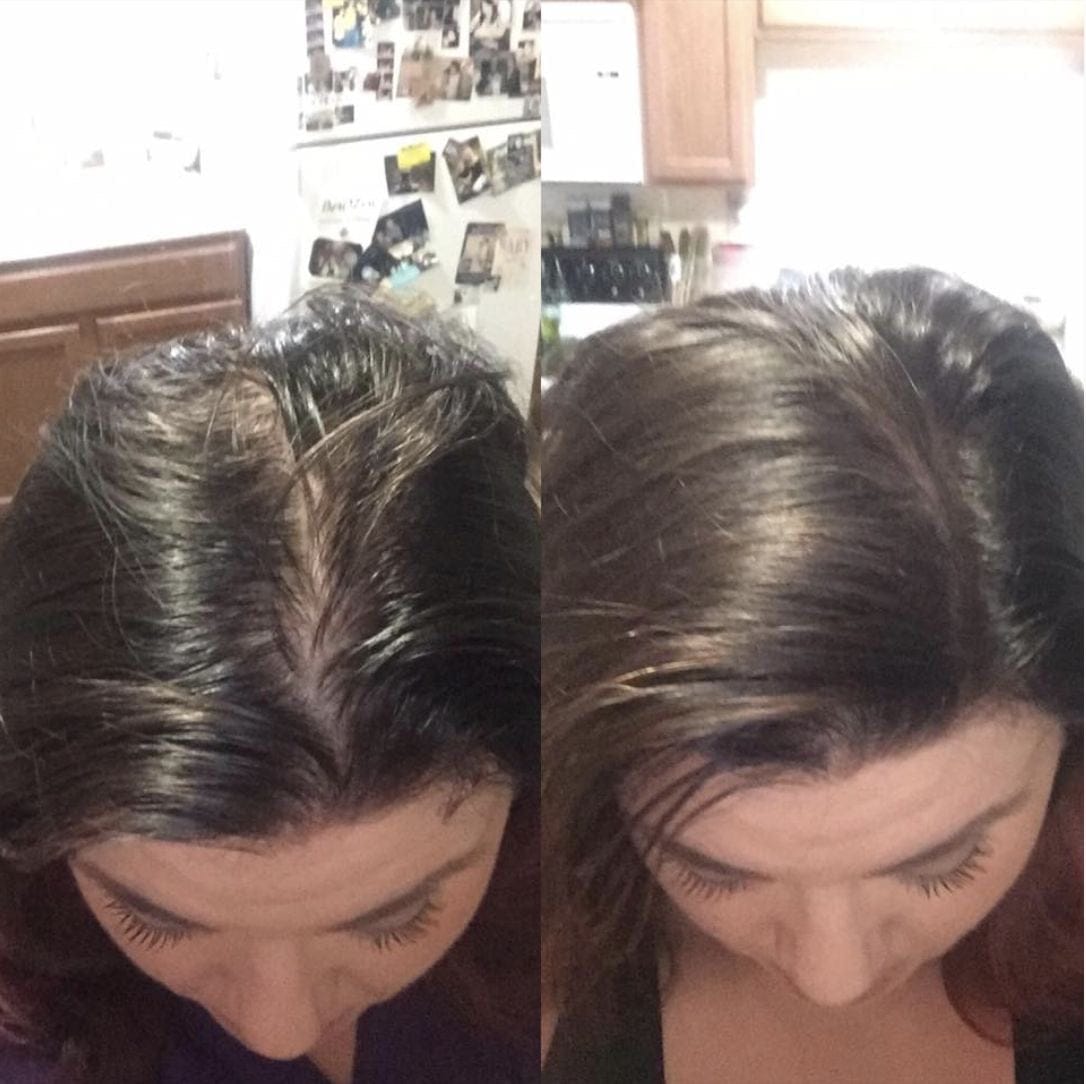 Customer photo review of DP Depur Shampoo Detossinante per capelli grassi