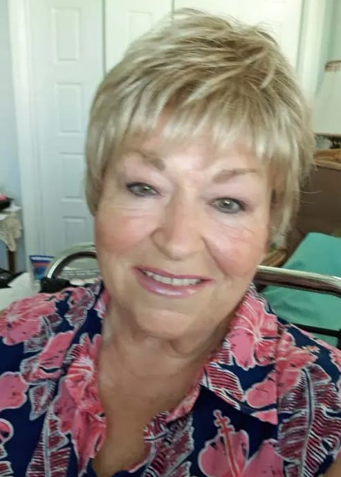 Customer photo review of High-Quality Short Hair Topper For Women With Thinning Hair