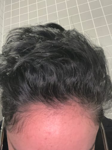 Customer photo review of Instant Dye Shampoo™ – Återfå färgen, utan dyra salongsbesök
