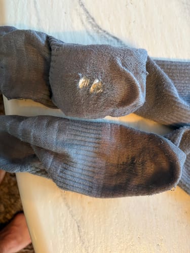 Customer photo review of Diasocks Støttestrømper