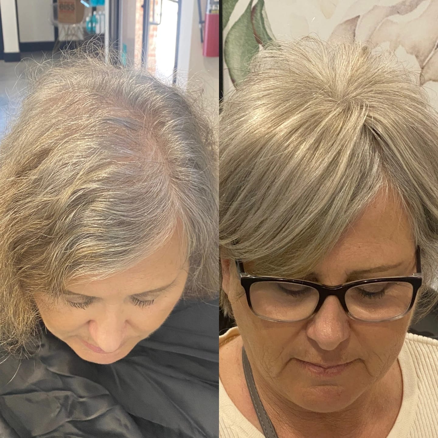 Customer photo review of Breathable&comfortable Short Hair Topper For Thinning Hair