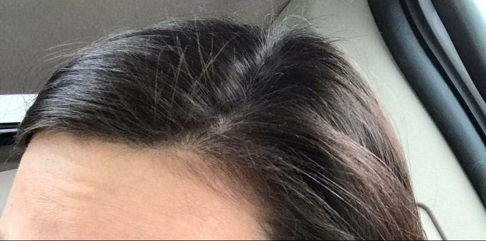 Customer photo review of DP Depur Shampoo Detossinante per capelli grassi