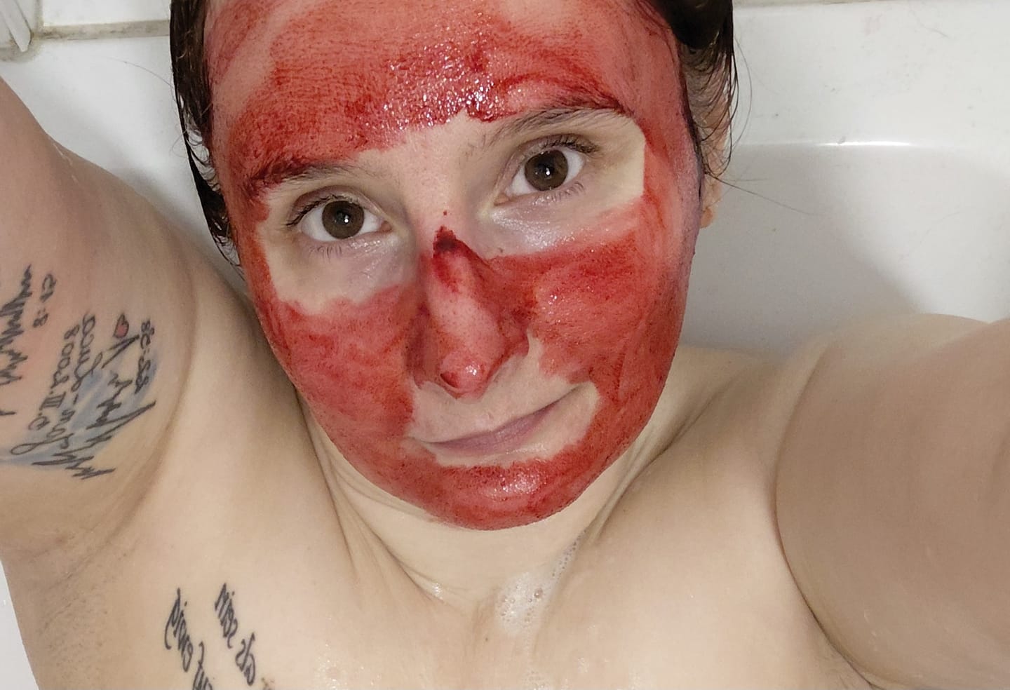 Customer photo review of VAMPIRE PEEL® - Fruchtsäurepeeling