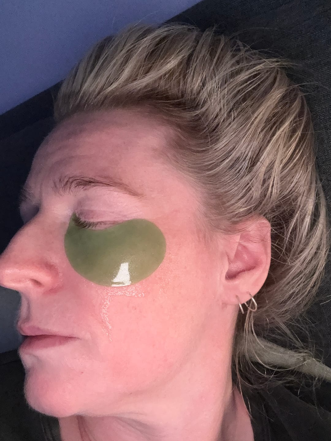 Customer photo review of Revitalising Eye Patches