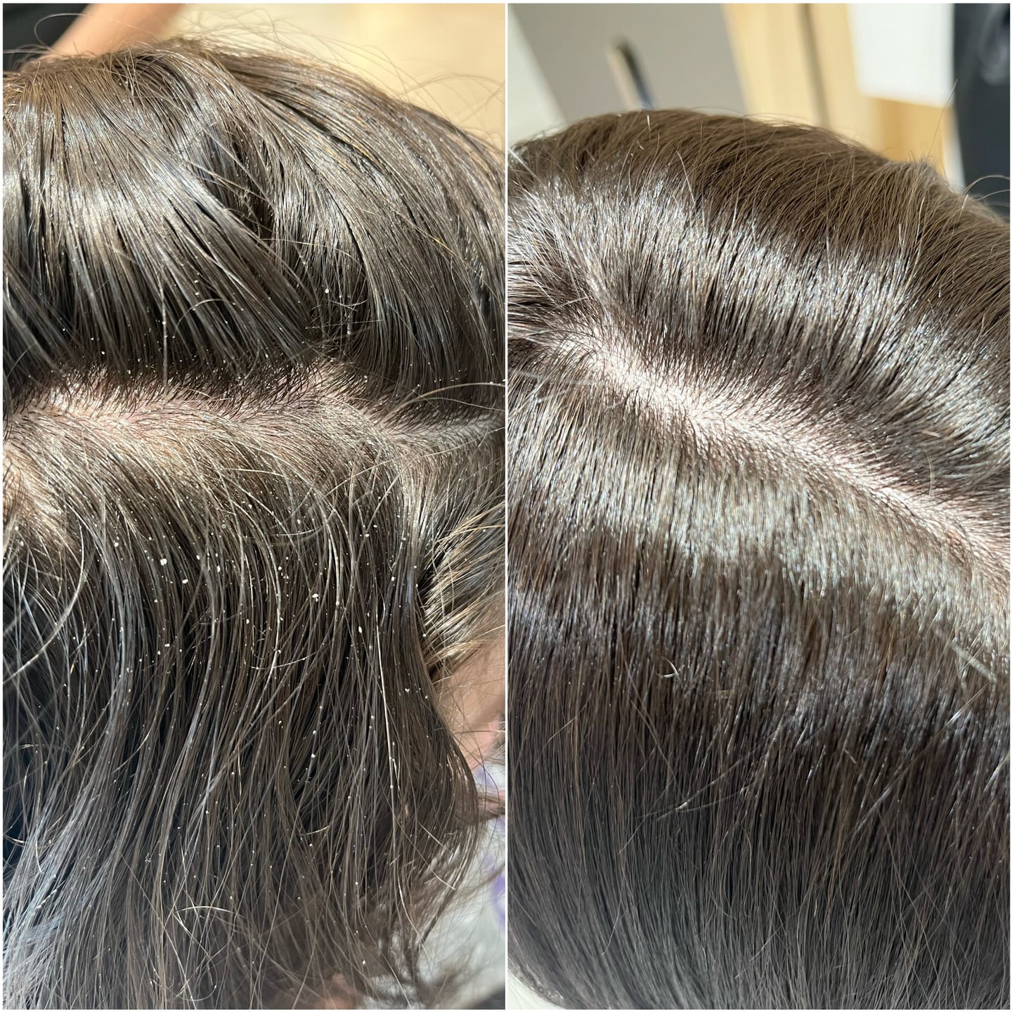 Customer photo review of LP Leniplus shampoo antiforfora