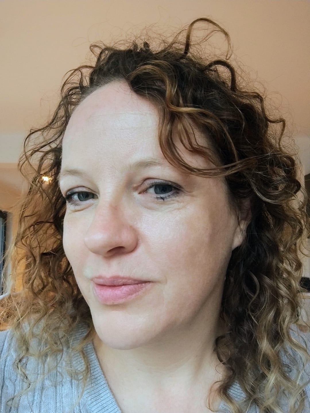 Customer photo review of 5-Step Clear Skin Kit