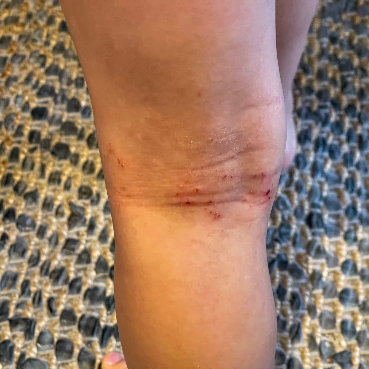 Customer photo review of Large Bioskin Junior Duo Pack