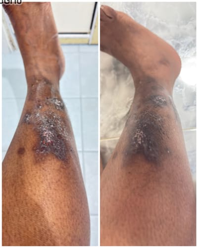 Customer photo review of Jolicare Cream