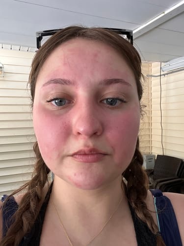 Katie T. review of Alcohol Flush and Hangover Reducer Capsules photo 1 out of 4