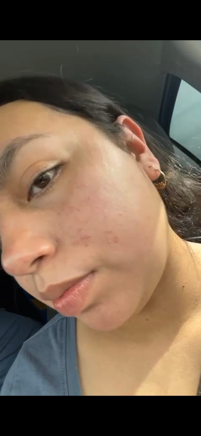 Customer photo review of Pure Clay Mask: Mascarilla Limpieza Profunda