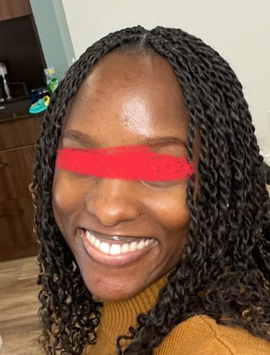 Customer photo review of ZO Wrinkle + Texture Repair