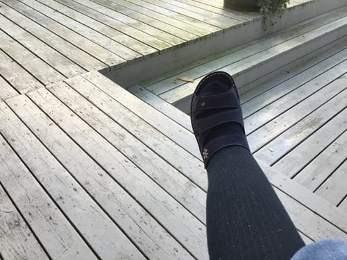 Customer photo review of Diasocks Støttestrømper