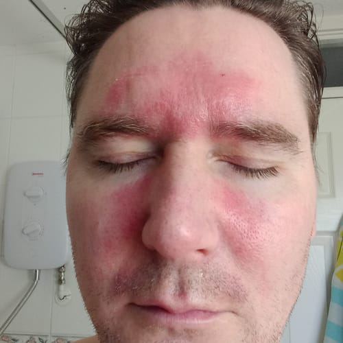 Customer photo review of Seb Natural Calming Serum