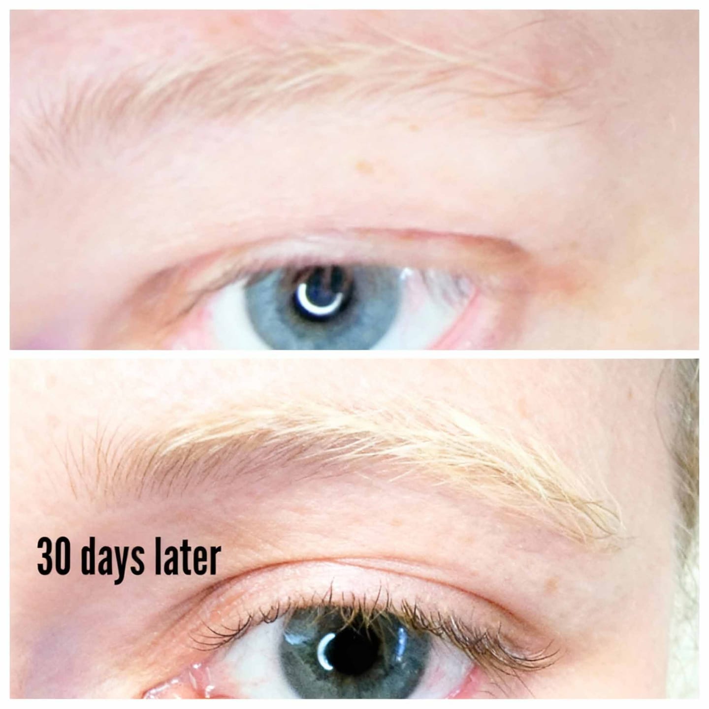 Customer photo review of LashGrow Serum