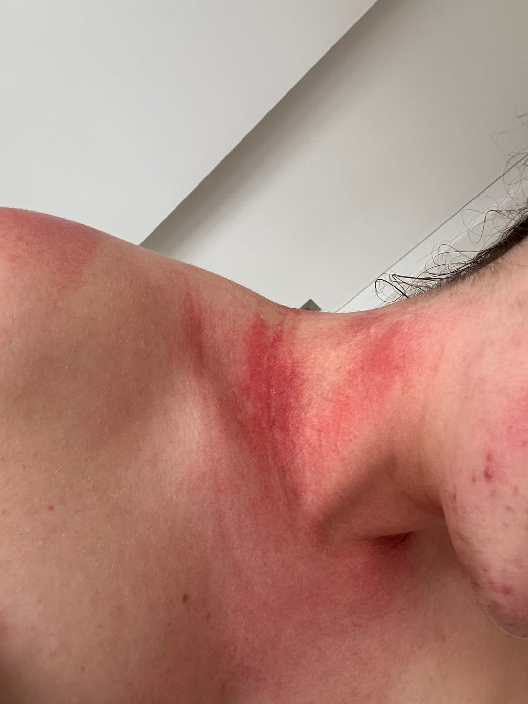 Customer photo review of Kawakawa Repair Balm - Winner, Best SOS/Healing Balm 2024