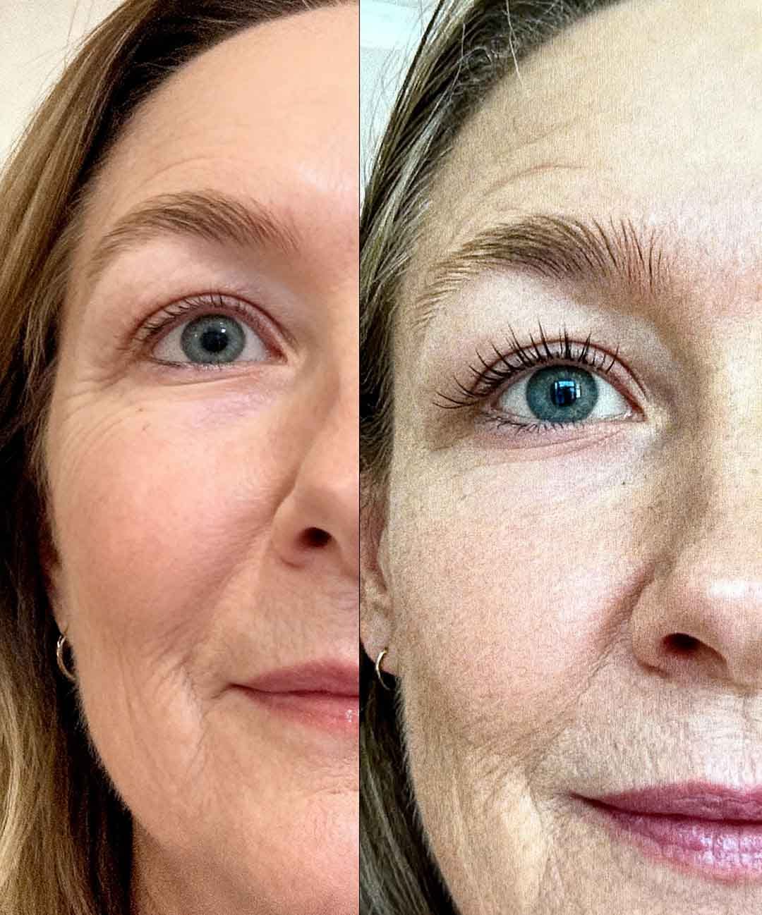 Customer photo review of LashGrow Serum