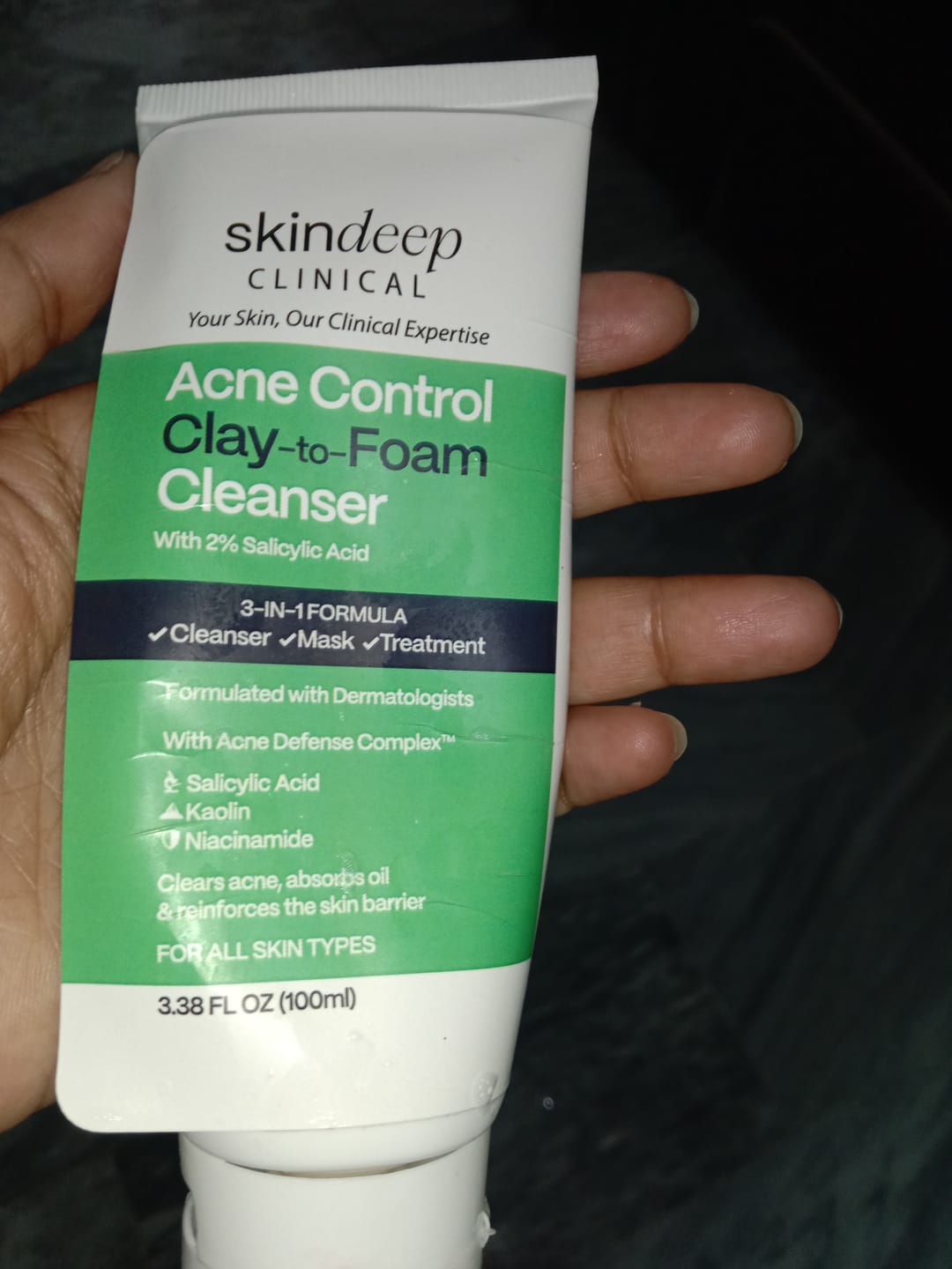 Customer photo review of Acne Control Clay-to-Foam Cleanser
