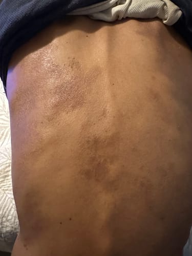 Customer photo review of Extra Strength Sweet Ginger Vapor Rub