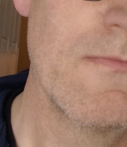 Customer photo review of Seb Natural Calming Serum