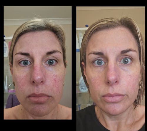 Customer photo review of SEA BUCKTHORN SERUM (5ml)