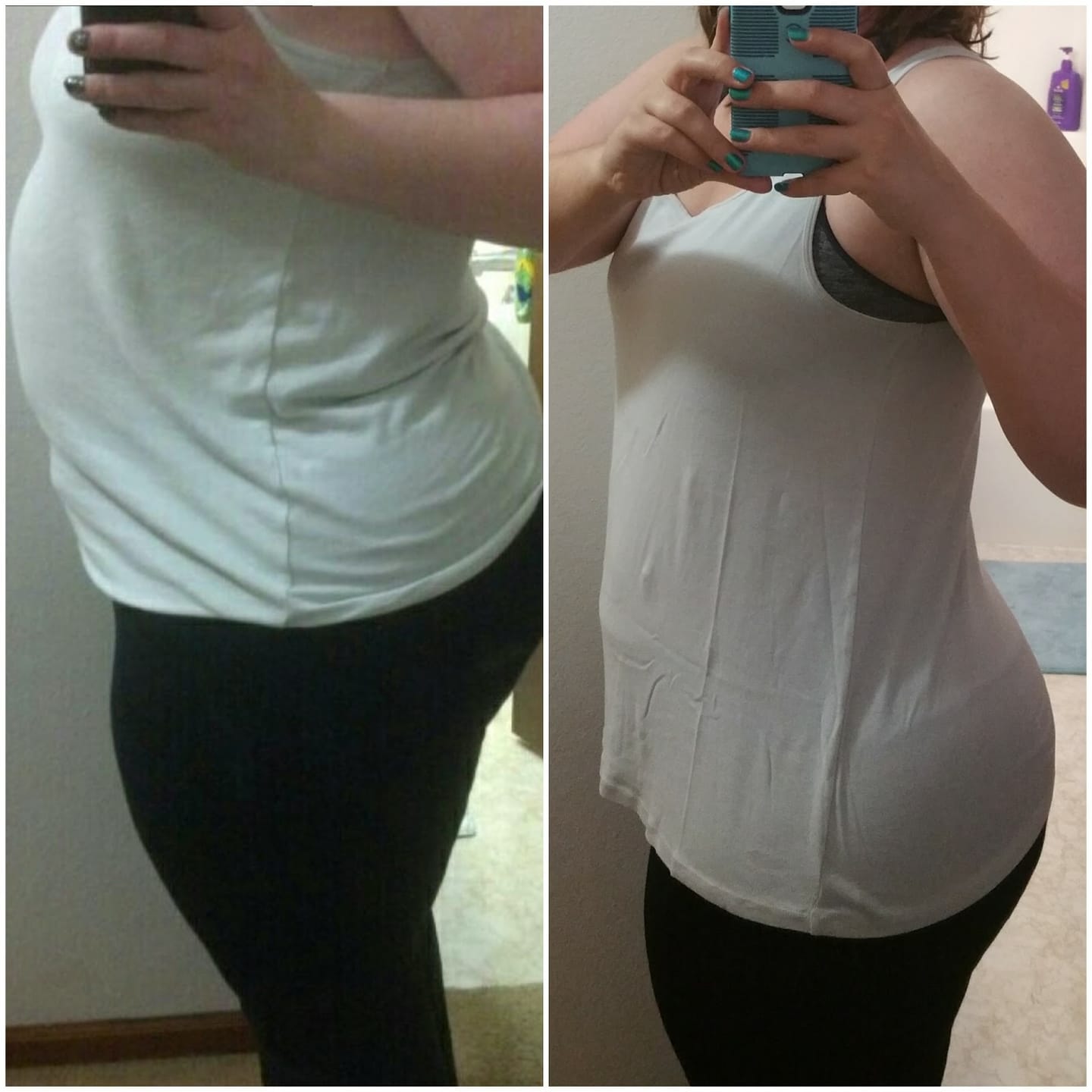 Customer photo review of NextGen Ultra Muscle Stimulator